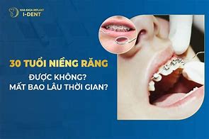 30 Tuổi Có Niềng Răng Được Không